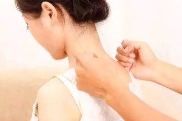 全身阳气的总开关